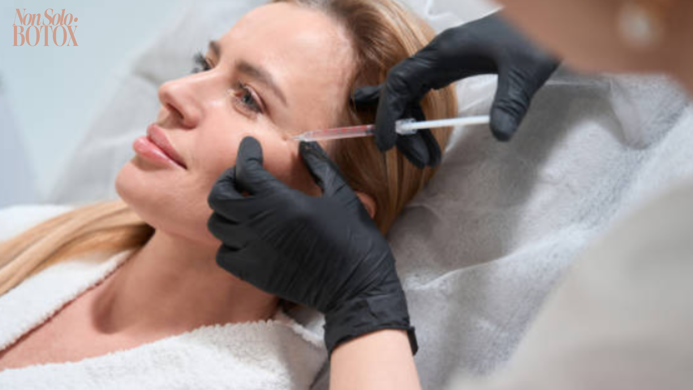 filler acido ialuronico - non solo botox